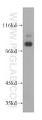 RAD18 E3 Ubiquitin Protein Ligase antibody, 18333-1-AP, Proteintech Group, Western Blot image 