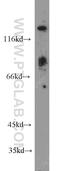 Bifunctional protein NCOAT antibody, 66033-1-Ig, Proteintech Group, Western Blot image 