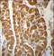 Late Endosomal/Lysosomal Adaptor, MAPK And MTOR Activator 2 antibody, LS-C162674, Lifespan Biosciences, Immunohistochemistry paraffin image 