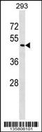 Zinc Finger Protein 24 antibody, 58-466, ProSci, Western Blot image 