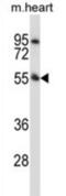 Serine/threonine-protein kinase PINK1, mitochondrial antibody, abx027915, Abbexa, Western Blot image 