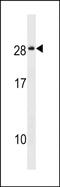 Sodium/Potassium Transporting ATPase Interacting 4 antibody, PA5-48959, Invitrogen Antibodies, Western Blot image 