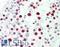 MutS Homolog 6 antibody, LS-B10739, Lifespan Biosciences, Immunohistochemistry paraffin image 