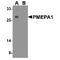 Prostate Transmembrane Protein, Androgen Induced 1 antibody, TA349193, Origene, Western Blot image 