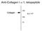 Collagen Type I Alpha 1 Chain antibody, GTX82720, GeneTex, Western Blot image 