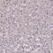 Zinc Finger CCCH-Type Containing 4 antibody, NBP1-88475, Novus Biologicals, Immunohistochemistry paraffin image 