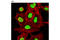 High Mobility Group Nucleosomal Binding Domain 2 antibody, 9437S, Cell Signaling Technology, Immunofluorescence image 