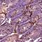 Cyp17 antibody, A00615-3, Boster Biological Technology, Immunohistochemistry paraffin image 