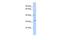 ZFP36 Ring Finger Protein antibody, PA5-41450, Invitrogen Antibodies, Western Blot image 