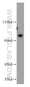 Protein Kinase C Epsilon antibody, 20877-1-AP, Proteintech Group, Western Blot image 