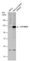GTF2I Repeat Domain Containing 1 antibody, GTX131433, GeneTex, Western Blot image 