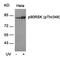 Ribosomal Protein S6 Kinase A1 antibody, 79-148, ProSci, Western Blot image 