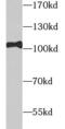DNA Topoisomerase I antibody, FNab09823, FineTest, Western Blot image 