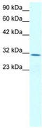 Claudin 17 antibody, TA334195, Origene, Western Blot image 