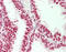 Apolipoprotein B MRNA Editing Enzyme Catalytic Subunit 3B antibody, LS-B12051, Lifespan Biosciences, Immunohistochemistry paraffin image 