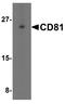 CD81 Molecule antibody, A01281, Boster Biological Technology, Western Blot image 