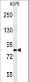 Cytoplasmic Polyadenylation Element Binding Protein 4 antibody, LS-C166989, Lifespan Biosciences, Western Blot image 