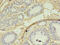 S-Phase Kinase Associated Protein 2 antibody, CSB-PA613392LA01HU, Cusabio, Immunohistochemistry paraffin image 