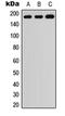 ADAM Metallopeptidase With Thrombospondin Type 1 Motif 7 antibody, orb234998, Biorbyt, Western Blot image 