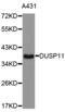Dual Specificity Phosphatase 11 antibody, abx004560, Abbexa, Western Blot image 