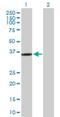 Kinesin Family Member 6 antibody, H00221458-D01P, Novus Biologicals, Western Blot image 