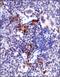 ATM Serine/Threonine Kinase antibody, NB100-306, Novus Biologicals, Immunohistochemistry paraffin image 