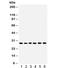 TNF Superfamily Member 13 antibody, R31837, NSJ Bioreagents, Western Blot image 
