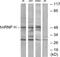 Heterogeneous Nuclear Ribonucleoprotein H1 antibody, PA5-38632, Invitrogen Antibodies, Western Blot image 