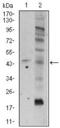 Frizzled Class Receptor 5 antibody, GTX60642, GeneTex, Western Blot image 