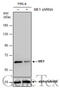 Malic Enzyme 1 antibody, GTX632189, GeneTex, Western Blot image 