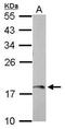 Amelogenin X-Linked antibody, PA5-31286, Invitrogen Antibodies, Western Blot image 