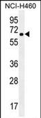 Cholinergic Receptor Nicotinic Delta Subunit antibody, PA5-71562, Invitrogen Antibodies, Western Blot image 