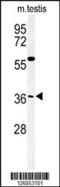 Coiled-Coil Domain Containing 92 antibody, 61-755, ProSci, Western Blot image 