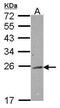 RAB2A, Member RAS Oncogene Family antibody, GTX114695, GeneTex, Western Blot image 