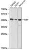 FGF1 Intracellular Binding Protein antibody, GTX53989, GeneTex, Western Blot image 