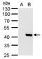 X-Ray Repair Cross Complementing 3 antibody, GTX100093, GeneTex, Western Blot image 