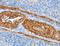 Alanyl-TRNA Synthetase antibody, LS-C406111, Lifespan Biosciences, Immunohistochemistry paraffin image 