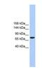 Transmembrane Channel Like 2 antibody, NBP1-59417, Novus Biologicals, Western Blot image 