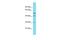 Glutaredoxin And Cysteine Rich Domain Containing 2 antibody, A17746, Boster Biological Technology, Western Blot image 