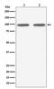 Fibroblast Growth Factor Receptor 3 antibody, M00200, Boster Biological Technology, Western Blot image 
