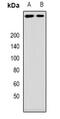 Ankyrin Repeat And KH Domain Containing 1 antibody, abx142058, Abbexa, Western Blot image 