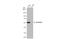 Aldehyde Dehydrogenase 1 Family Member A2 antibody, GTX115147, GeneTex, Western Blot image 