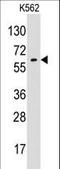 Glypican 6 antibody, LS-B10702, Lifespan Biosciences, Western Blot image 