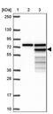 Homocysteine Inducible ER Protein With Ubiquitin Like Domain 1 antibody, PA5-59485, Invitrogen Antibodies, Western Blot image 