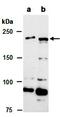Tet Methylcytosine Dioxygenase 1 antibody, orb66692, Biorbyt, Western Blot image 