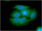 Arginase 2 antibody, GTX57645, GeneTex, Immunofluorescence image 