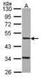 Farnesyltransferase, CAAX Box, Beta antibody, NBP2-14960, Novus Biologicals, Western Blot image 
