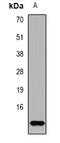 General Transcription Factor IIA Subunit 2 antibody, abx225206, Abbexa, Western Blot image 