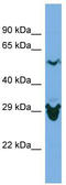 Selenophosphate Synthetase 2 antibody, TA346766, Origene, Western Blot image 