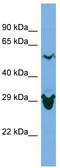 Selenide, water dikinase 2 antibody, TA346766, Origene, Western Blot image 